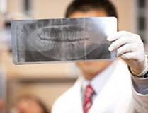 перелом челюсти